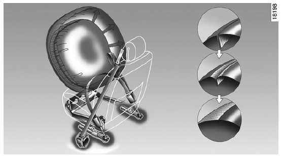 Particularité de l'airbag frontal